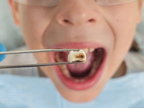 Best 24-Hour Emergency Dental Care in Bystrom, CA