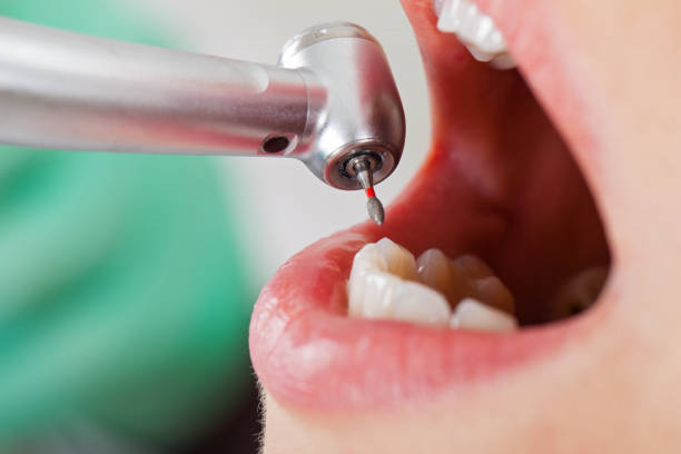 Best Urgent Dental Care for Toothaches in Bystrom, CA